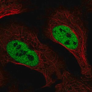 Merck Anti-SLC4A3 antibody produced in rabbit