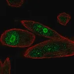 Merck Anti-PHLDA1 antibody produced in rabbit