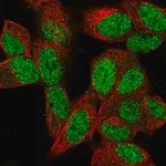 Merck Anti-PCGF2 antibody produced in rabbit