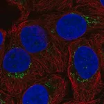 Merck Anti-B4GALT4 antibody produced in rabbit