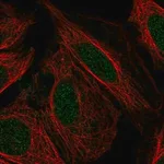 Merck Anti-PFKFB2 antibody produced in rabbit