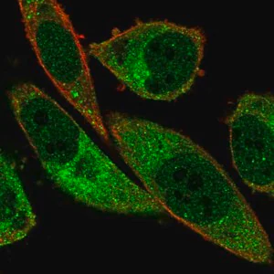 Merck Anti-ABCA13 antibody produced in rabbit