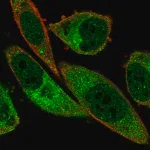Merck Anti-ABCA13 antibody produced in rabbit
