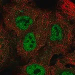 Merck Anti-NUP98 antibody produced in rabbit