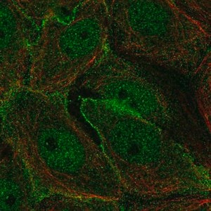 Merck Anti-MARK2 antibody produced in rabbit