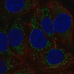 Merck Anti-MTHFD1L antibody produced in rabbit