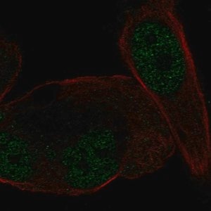 Merck Anti-NR3C2 antibody produced in rabbit