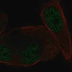 Merck Anti-NR3C2 antibody produced in rabbit
