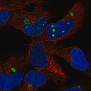 Merck Anti-HEY2 antibody produced in rabbit