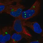 Merck Anti-HEY2 antibody produced in rabbit