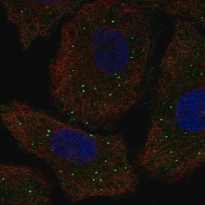 Merck Anti-GALNT9 antibody produced in rabbit