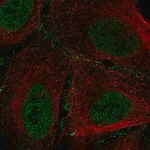 Merck Anti-ARID1B antibody produced in rabbit