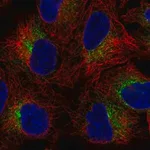 Merck Anti-SLC39A9 antibody produced in rabbit