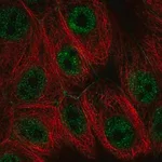 Merck Anti-PI4KA antibody produced in rabbit