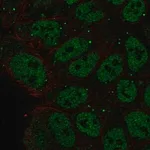 Merck Anti-ZNF585B antibody produced in rabbit