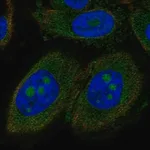 Merck Anti-CCDC7 antibody produced in rabbit