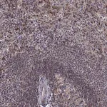 Merck Anti-MTSS1 antibody produced in rabbit