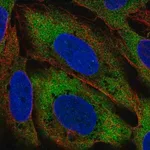 Merck Anti-CIT antibody produced in rabbit