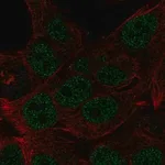 Merck Anti-HOXB8 antibody produced in rabbit