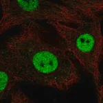Merck Anti-RFWD3 antibody produced in rabbit
