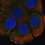 Merck Anti-ATP2C2 antibody produced in rabbit