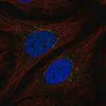 Merck Anti-STEAP4 antibody produced in rabbit
