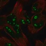 Merck Anti-HERPUD2 antibody produced in rabbit