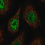 Merck Anti-PCDHAC2 antibody produced in rabbit