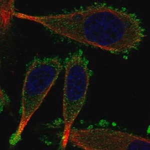 Merck Anti-KRT75 antibody produced in rabbit