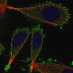 Merck Anti-KRT75 antibody produced in rabbit