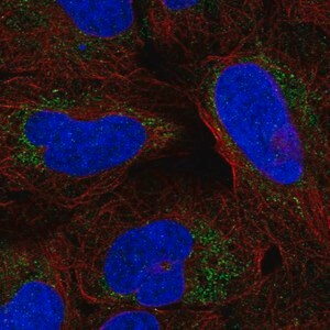 Merck Anti-ARHGAP20 antibody produced in rabbit