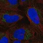 Merck Anti-ARHGAP20 antibody produced in rabbit