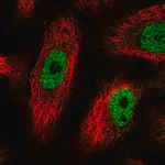 Merck Anti-PHF12 antibody produced in rabbit
