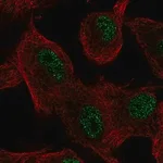 Merck Anti-SLC39A11 antibody produced in rabbit
