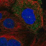 Merck Anti-SDCCAG8 antibody produced in rabbit