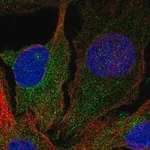 Merck Anti-DGKD antibody produced in rabbit