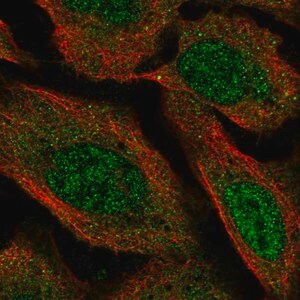 Merck Anti-VPS13D antibody produced in rabbit