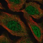 Merck Anti-VPS13D antibody produced in rabbit