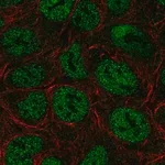 Merck Anti-TRERF1 antibody produced in rabbit