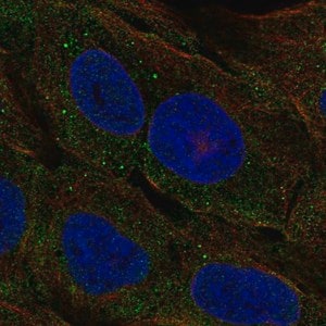 Merck Anti-CELA3A antibody produced in rabbit