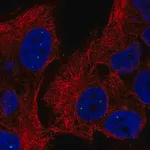 Merck Anti-TYW5 antibody produced in rabbit