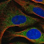 Merck Anti-ARMC7 antibody produced in rabbit