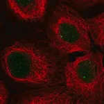 Merck Anti-SNAPC3 antibody produced in rabbit