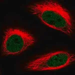 Merck Anti-HMG20B antibody produced in rabbit