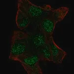 Merck Anti-UBE2V1 antibody produced in rabbit