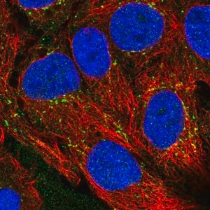 Merck Anti-CXCL16 antibody produced in rabbit