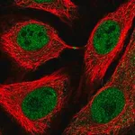 Merck Anti-USP3 antibody produced in rabbit