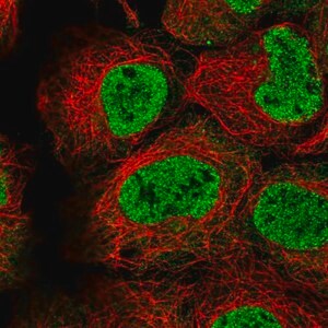 Merck Anti-TMEM98 antibody produced in rabbit