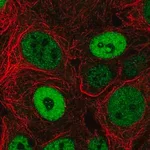 Merck Anti-BCL9L antibody produced in rabbit