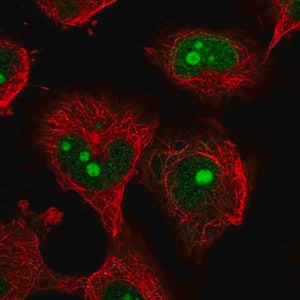 Merck Anti-NOC4L antibody produced in rabbit